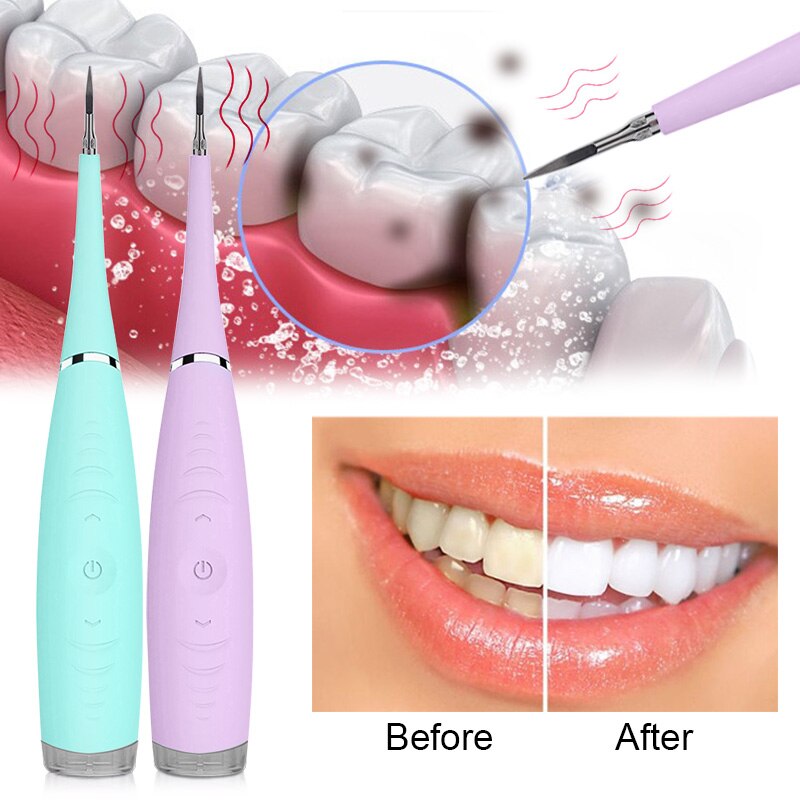 Portable Electric Sonic Dental Scaler Sonic Remover Stains Tartar Plaque Tooth Calculus Tool Teeth Health Hygiene Whitening