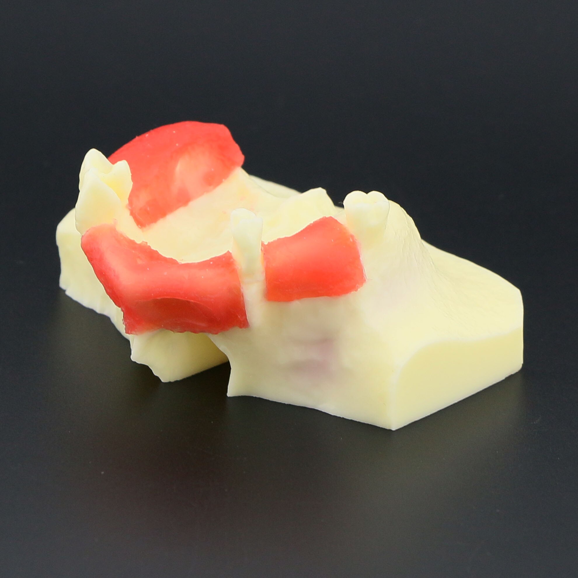 Dental Implant Teeth Model M2012 Typodont Maxillary Sinus Lift Practice Model Resin Tooth Demo For Teaching Study