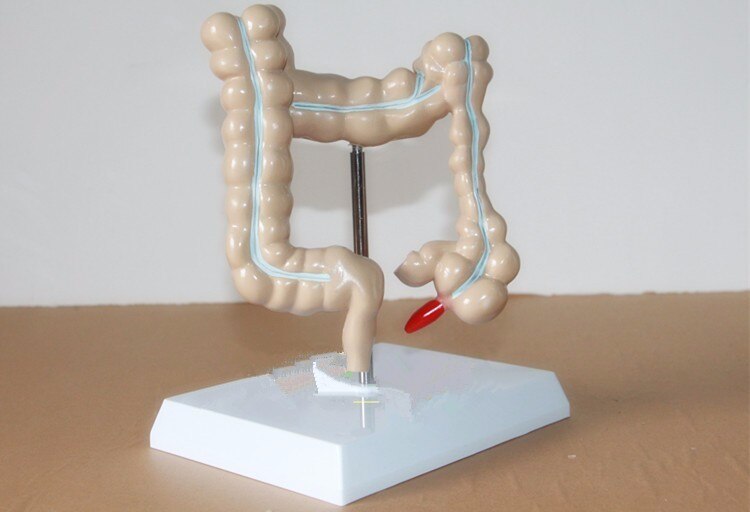 4D rozmiar życia Model choroby jelita grubego Model patologiczny jelita grubego gastroenterologia AIDS anatomiczna czaszka medyczna