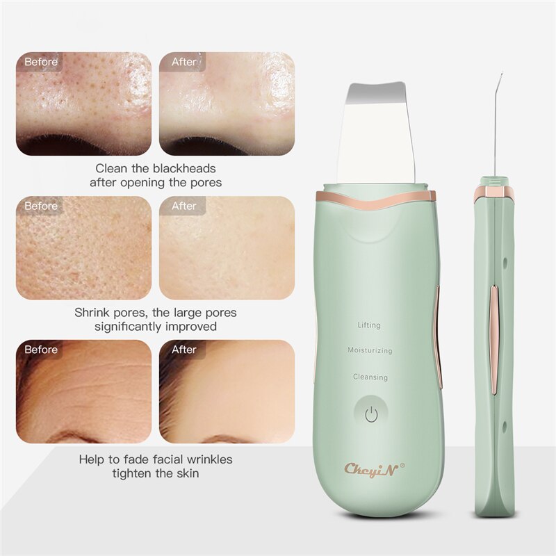 Ultrasonic Skin Scrubber Vibration Face Spatula Facial Pore Cleaner Blackhead Remover Exfoliator Peeling Shovel Lifting Massager