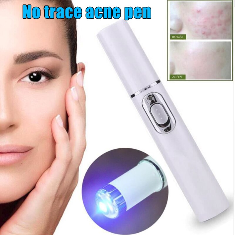 Stylo Portable anti-acné à lumière bleue, outil de soins de la peau, suppression des rides, SHRA889: Default Title