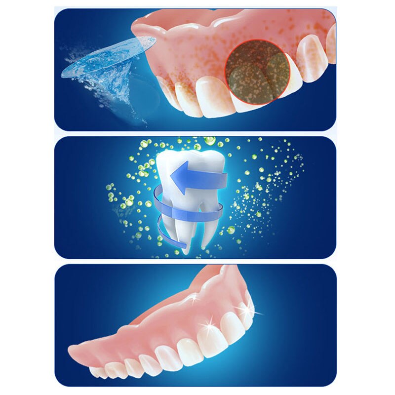 Denture Ultrasonic Cleaner Bath False Teeth Auto Dental Cleaning Machine Sterilization Teeth Care Easy Operated