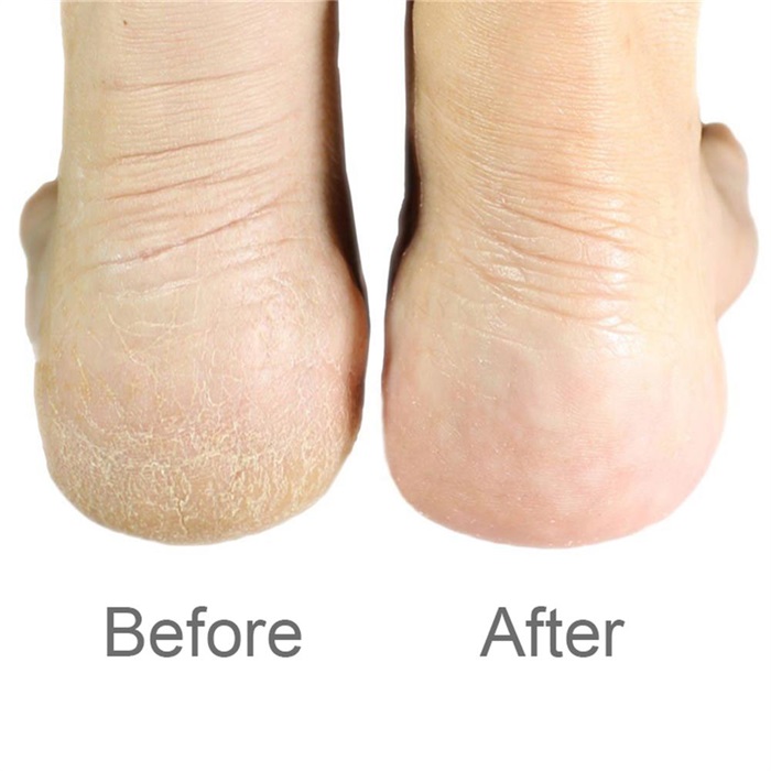 1 ud. De pulido de pedicura, Lima de doble cara, rallador de talón para los pies, rascador de pedicura, removedor de escofina de Metal, herramientas de manicura