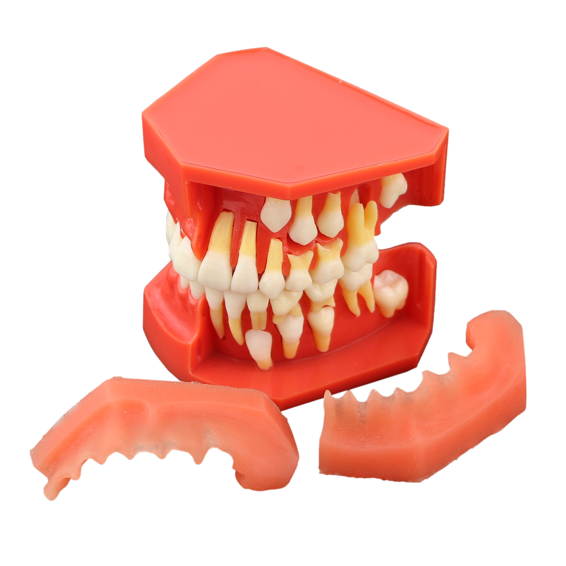 Dental Teeth Model M7013 Typodont Pediatric Development 9-12 Years Constant Teeth Grow Replace Demo Anatomy Teaching Study: Default Title