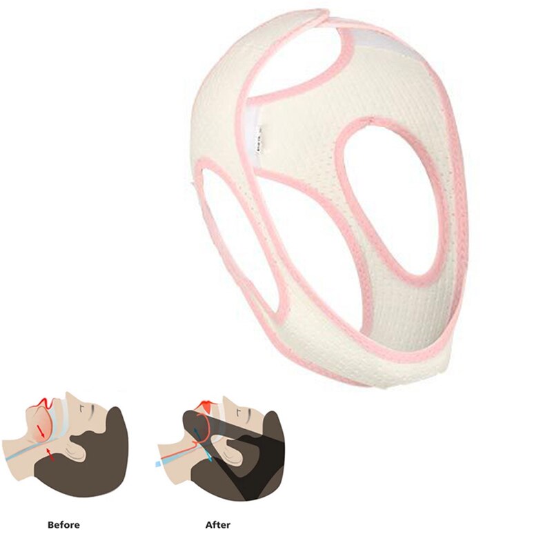 Anti Snurken Slapen Kinband Beste Stop Snurken Apparaat Verstelbare Snurken Vermindering Riem Slaapmiddelen Kin Strips Riem Voor Unisex