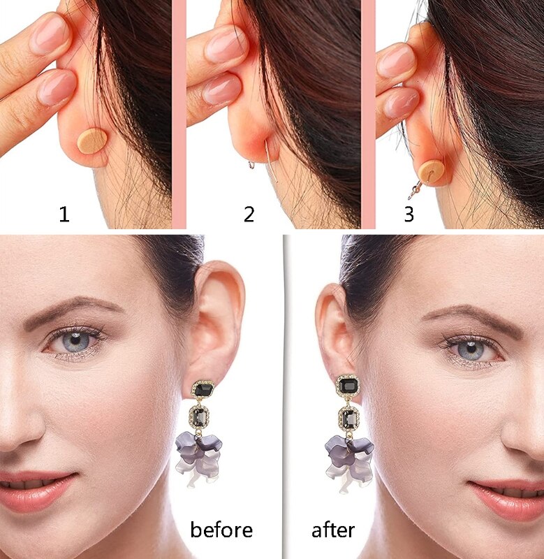 Oorbel Ondersteuning Patches Oorbel Lifters Clear Skin Kleur Waterdichte Oorbel Oorlel Ondersteuning Patch Voor Oorbel