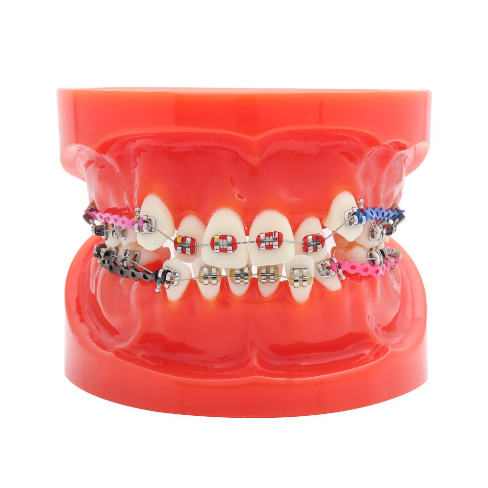 Dental Model Teeth Model Dental Teaching Model Standard Model with 32 Screw-in Teeths Demonstration Soft Hard Gum 28 24 Teeth: Model Red