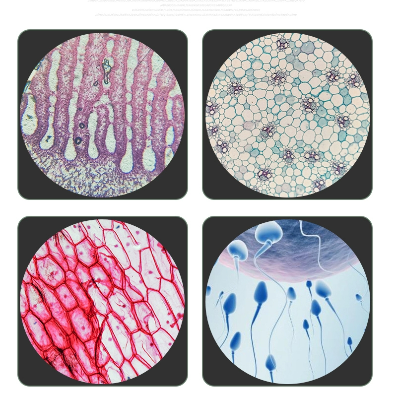 4X 10X 20X 40X 60X 100X Achromatic Objective Lens 195 mm Conjugate Distance Tube Length 160 mm Biological Microscope RMS thread