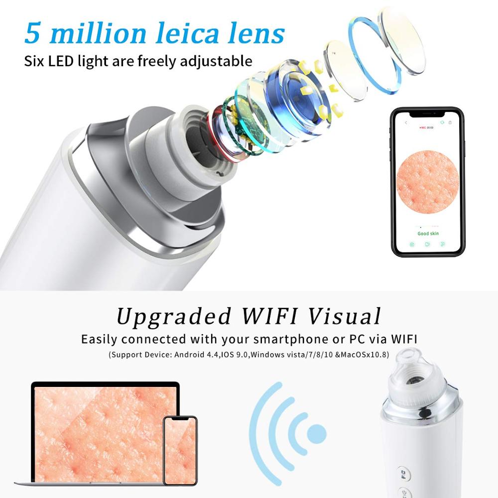 Blackhead Remover Vacuum WiFi Visual Facial Pimple Sucker Removal Extractor Tool with 6 Replaceable Probes Acne Pore Suction