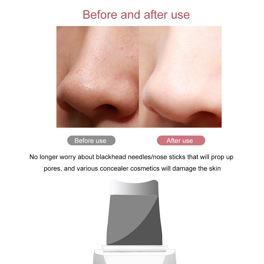 Vibrating Face Cleaner Machine Skin Scrubber Remove Dirt Blackhead Grease and Makeup Dirt Facial Whitening Lifting Tools