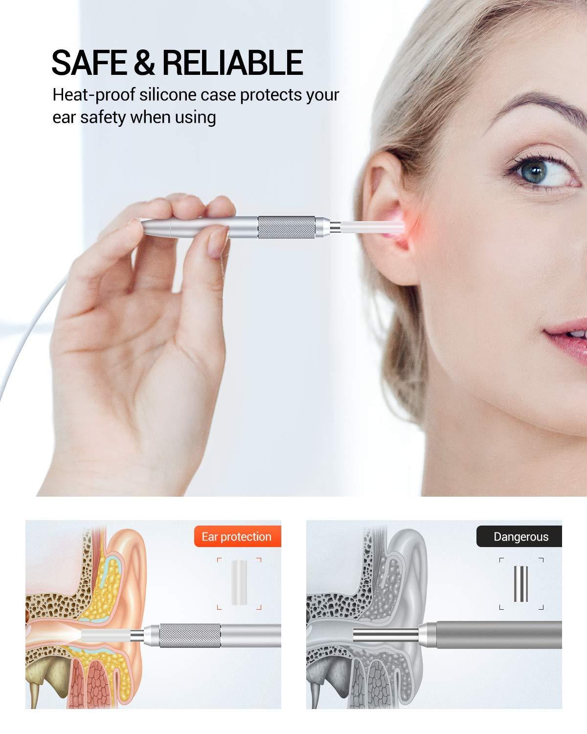 DEPSTECH-Otoscope USB NTE390 720P HD, caméra pour Inspection d'oreille, avec 6 endoscopes LED ajustables, pour téléphone Android et Windows/Mac et PC