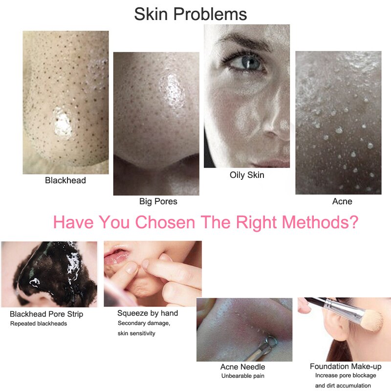 Ultrasonic Skin Scrubber Deep Cleaner Vibration Face Spatula Blackhead Remover Facial Scrubber Shovel Clean Cavitation Peeling