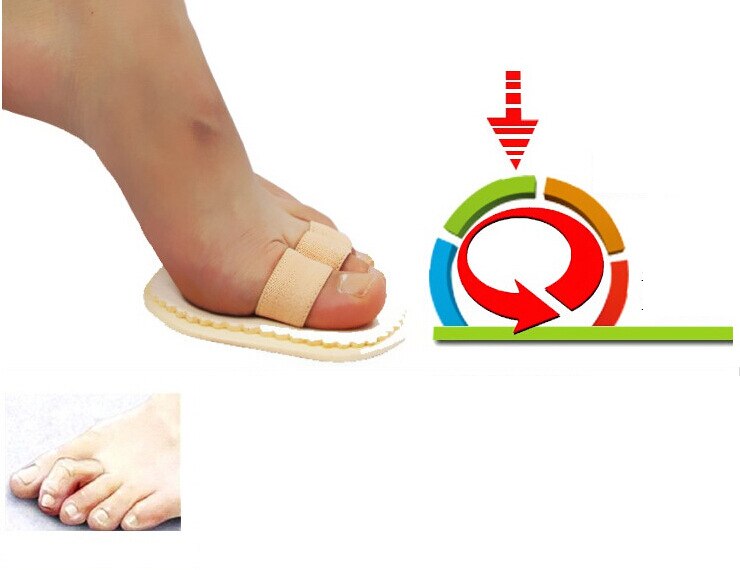Feet Care Hallux Valgus Orthopedic Metatarsal Crooked Overlapping Hammer Toe Straightener Corrector Foot Massager C128