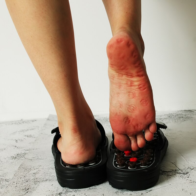 Acupunt Massage Slippers Voor Vrouwen Sandalen Voeten Chinese Acupressuur Therapie Medische Roterende Voet Massager Schoenen Unisex