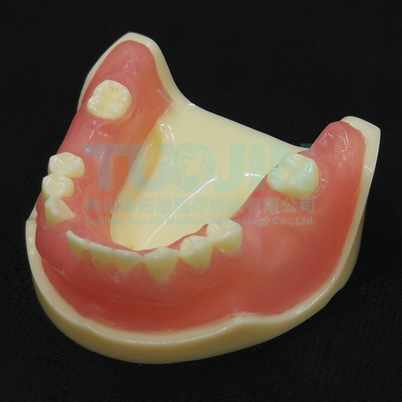 Dental Harz Zähne Tipodont Modell Für Dental Techniker Praxis Lehre Gum Zähne Kiefer Modell Zahnmedizin Ausrüstung: TYPE 12