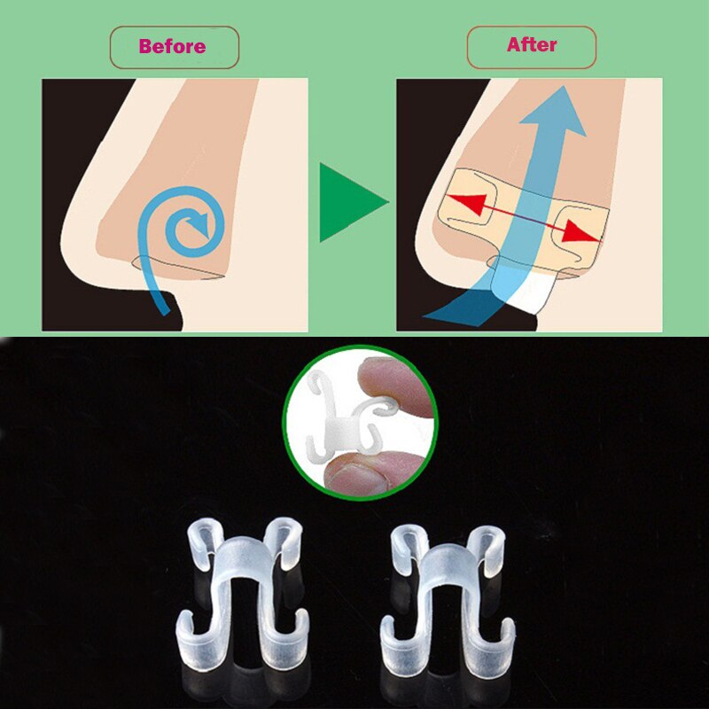 Ayuda para dormir saludable Anti-ronquido dispositivo para Anti-ronquido Apnea del sueño nariz respirar Clip para dispositivo Para Roncar dormir herramientas de ayuda
