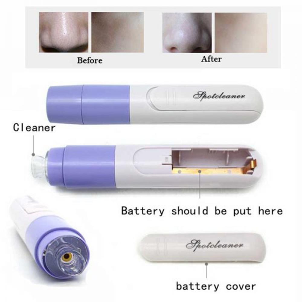 Electric Facial Pore Blackhead Cleaner Remover Vacuum Acne Microdermabrasion Facial Pore Cleanser Blackhead Suction Remover