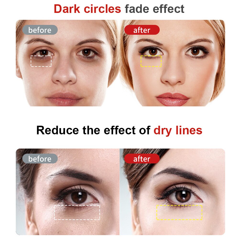 RF radiofrequenza massaggiatore per occhi massaggiatore antirughe antirughe dispositivo elettrico portatile cerchio scuro trattamenti per il viso penna per massaggio a vibrazione