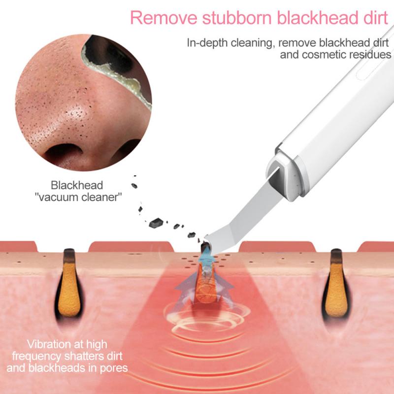 Ultrasone Verneveling Trillingen Elimineren Mee-eters Multifunctionele Gezichtsreiniger Professionele Gezicht Wassen Instrument