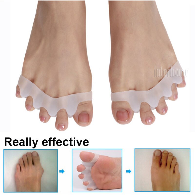 5 tenen Voet Brace Hallux Valgus Correctie Overlappende Hamer Separator Correctie Voet Spalk Bone Orthopedische Apparaat Voeten Zorg