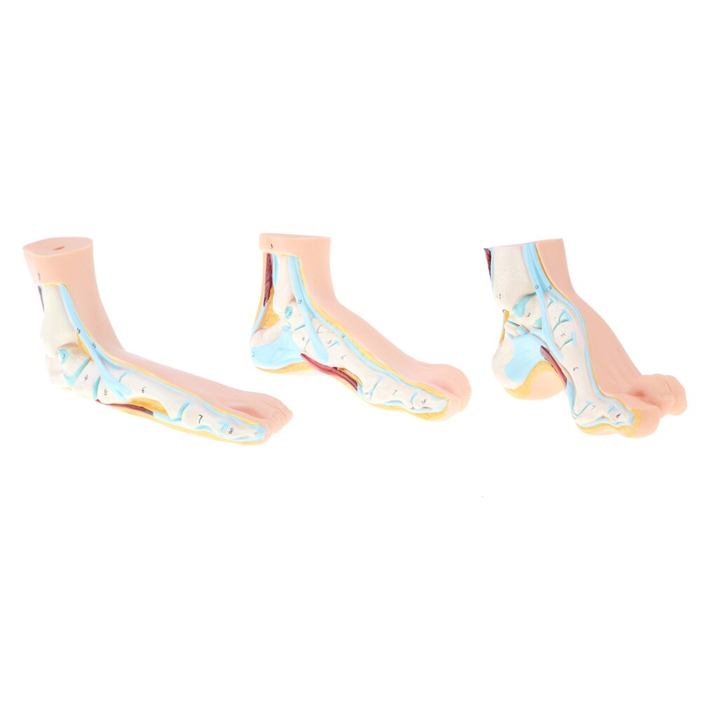 1:1 Lifesize Human Normal/ Arched/ Flat Foot Model with Ligaments Bones Muscles Anatomical Model Kit