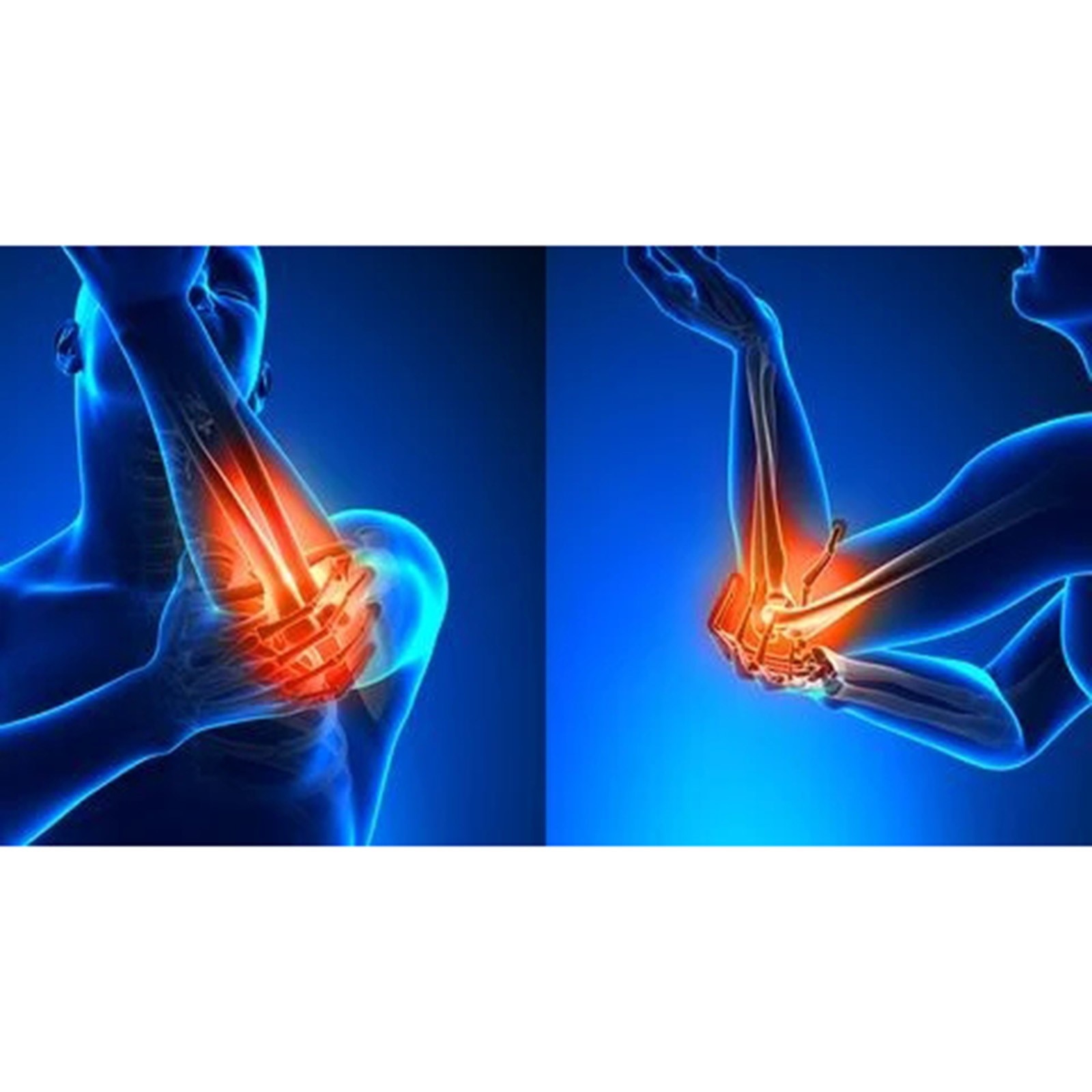 Finger Strength Exerciser Fidget Toys For Autism Anti Stress Fidget Toy Autismo Finger Trainer Antistress Autism Sensory Toy