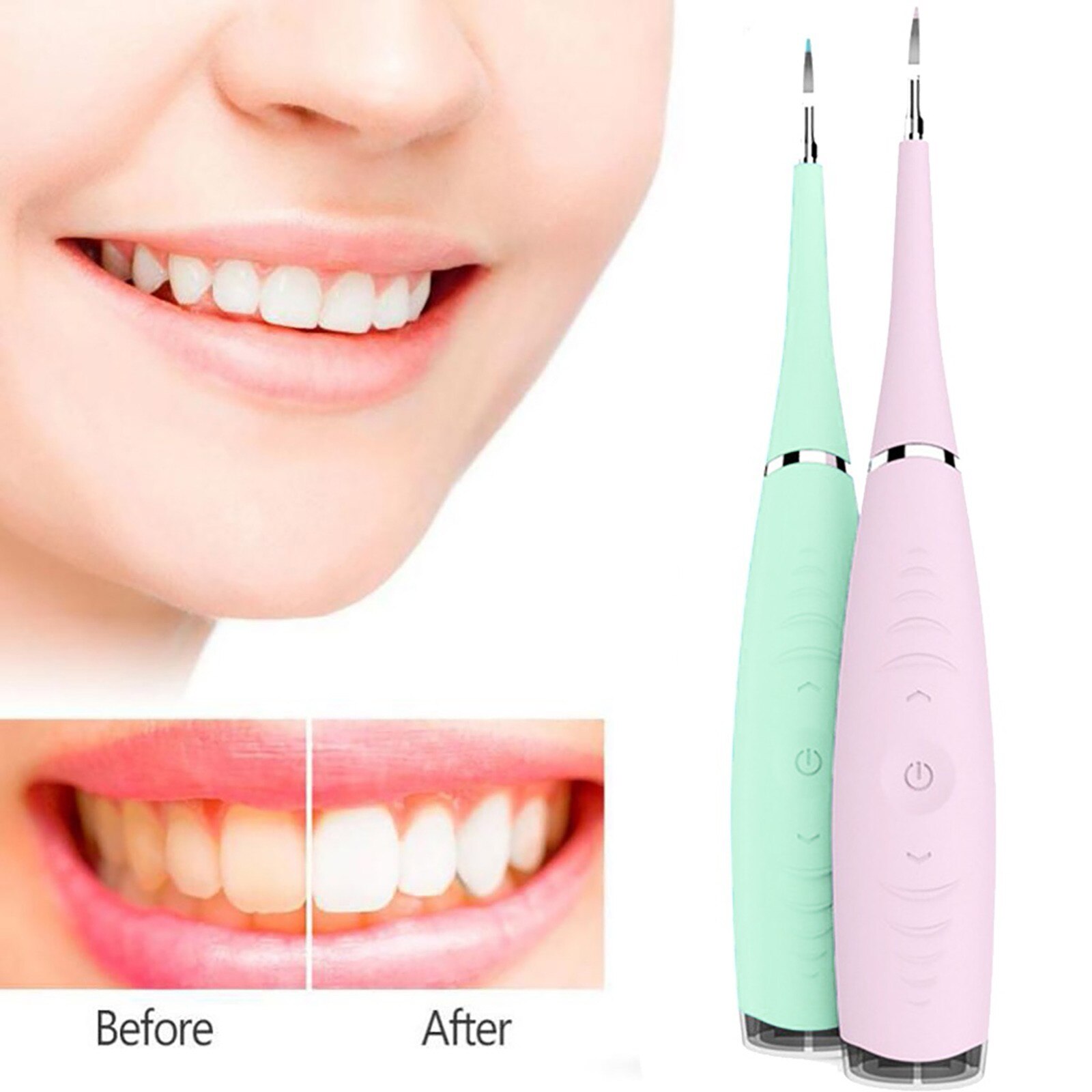 Electric Ultrasonic Sonic Dental Scaler Tooth Calculus Remover Cleaner Tooth Stains Tartar Tool Tartar Whiten Teeth Cleaner