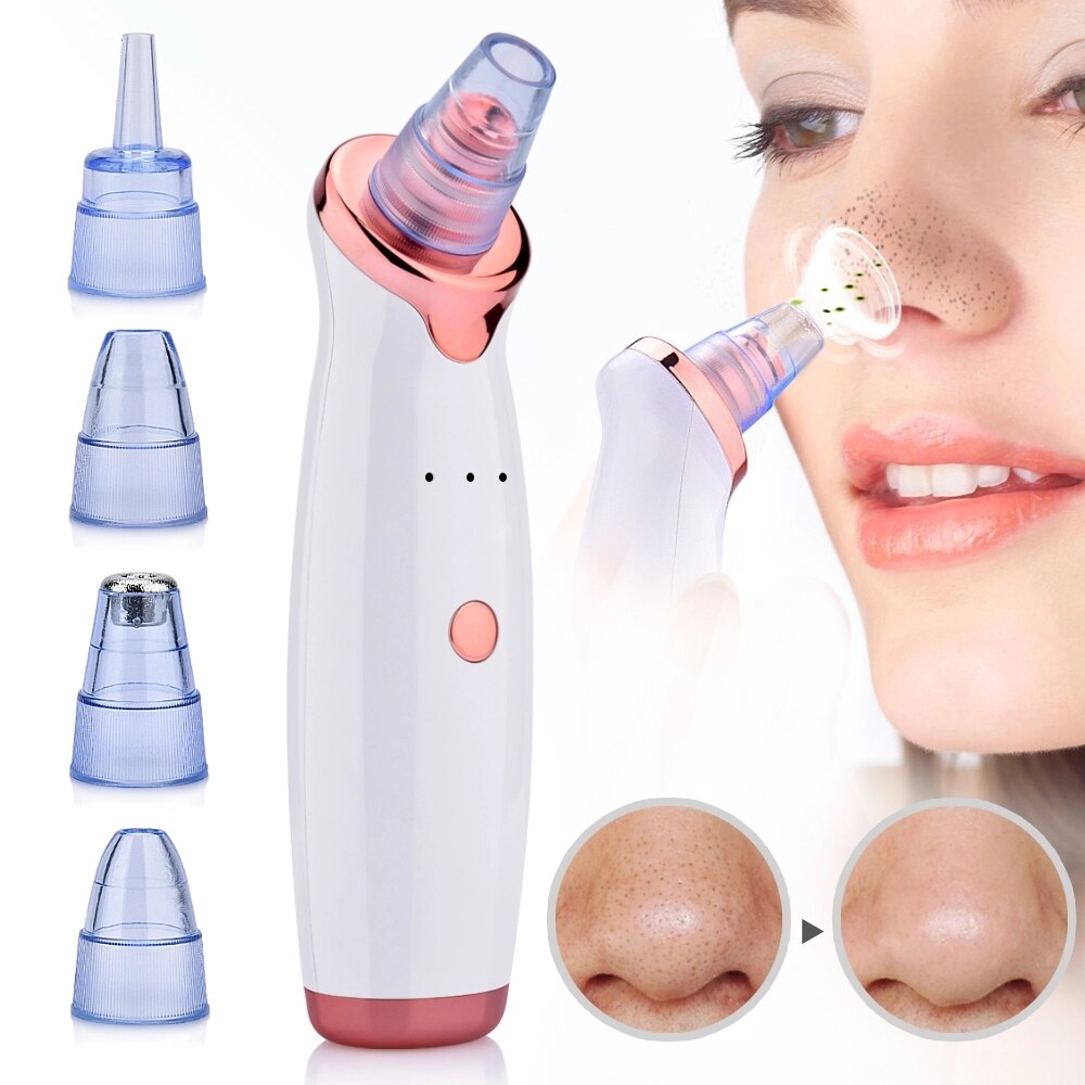 Máquina limpiadora de poros Y1, eliminador de espinillas faciales, limpiador eléctrico de poros y puntos negros: White
