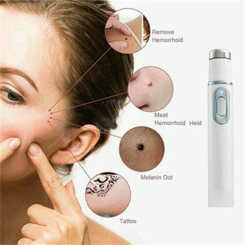 Stylo Portable anti-acné à lumière bleue, outil de soins de la peau, suppression des rides, SHRA889
