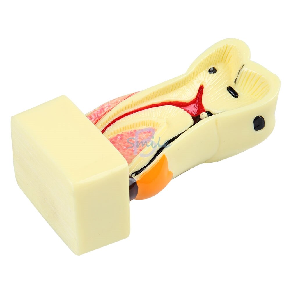 1pcs Dental Tooth Neuroanatomy Teaching Model 4 times transparent molar profile model with nerve Pathological Tooth Model