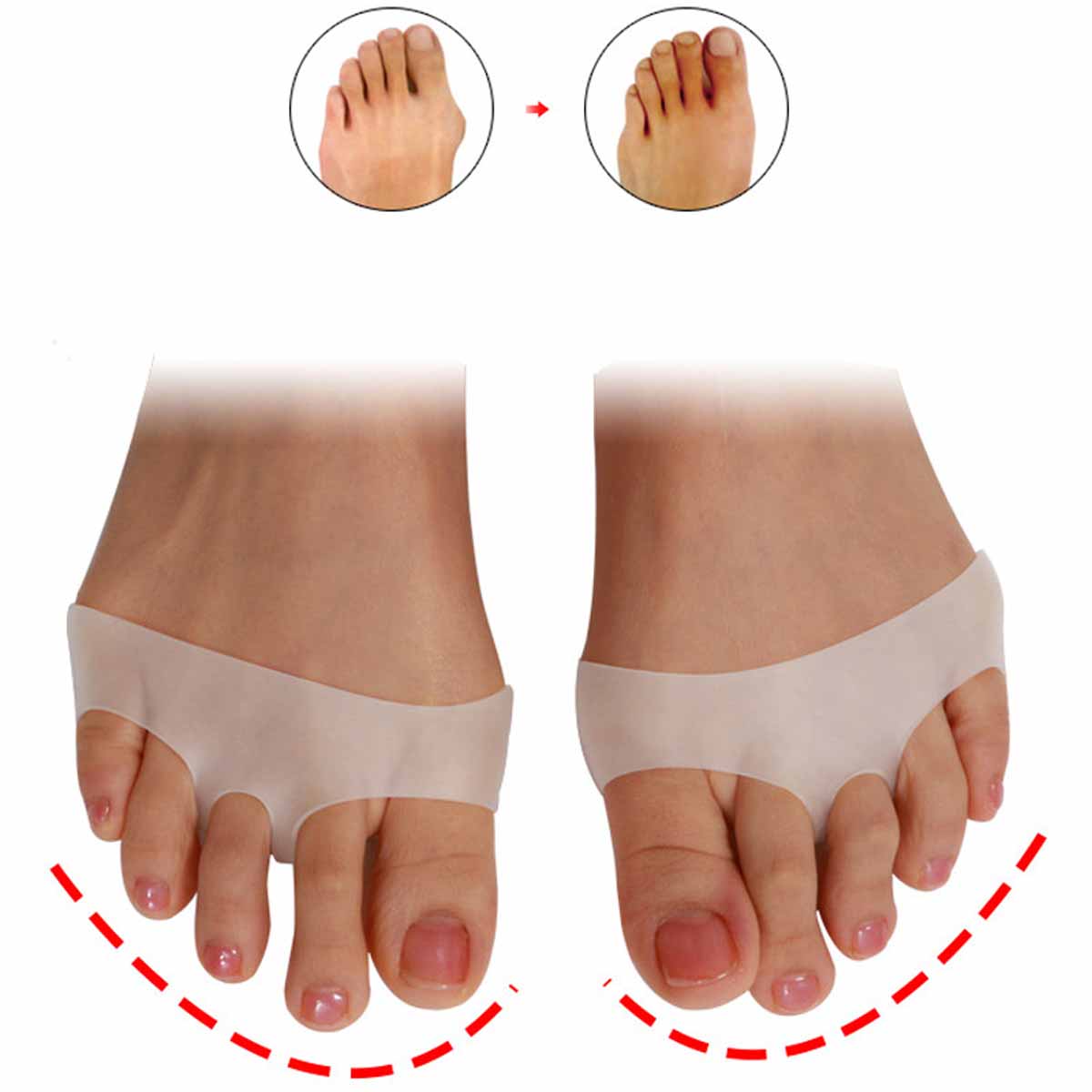 1 Paar Teen Pads Zachte Siliconen Gel Shock Anti Voorvoet Pad Teen Separator Metatarsal Correctie Voetverzorging Schoenen Kussen