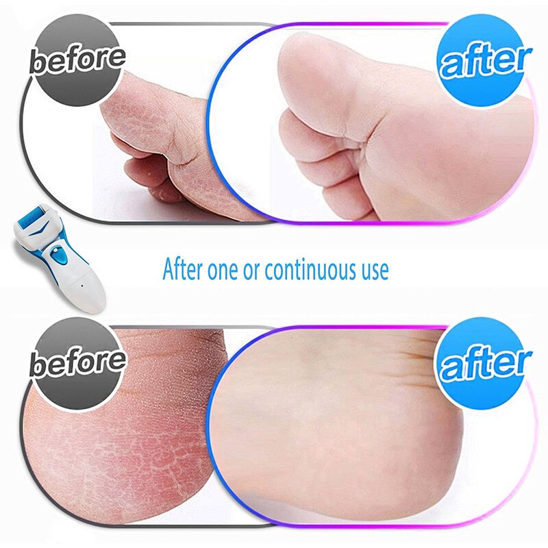 Portable Electric Repairing Foot File Machine Feet Care Health Tools Waterproof washable Grinding Foot Tool Pedicure Device