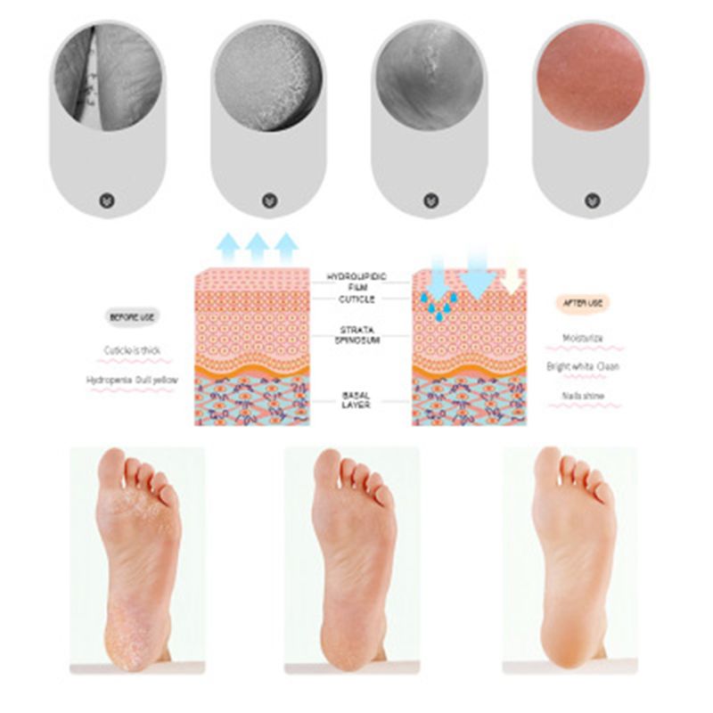 1 paire Silicone bateau chaussettes hommes femmes pied Anti-fissuration hydratant chaussette de protection