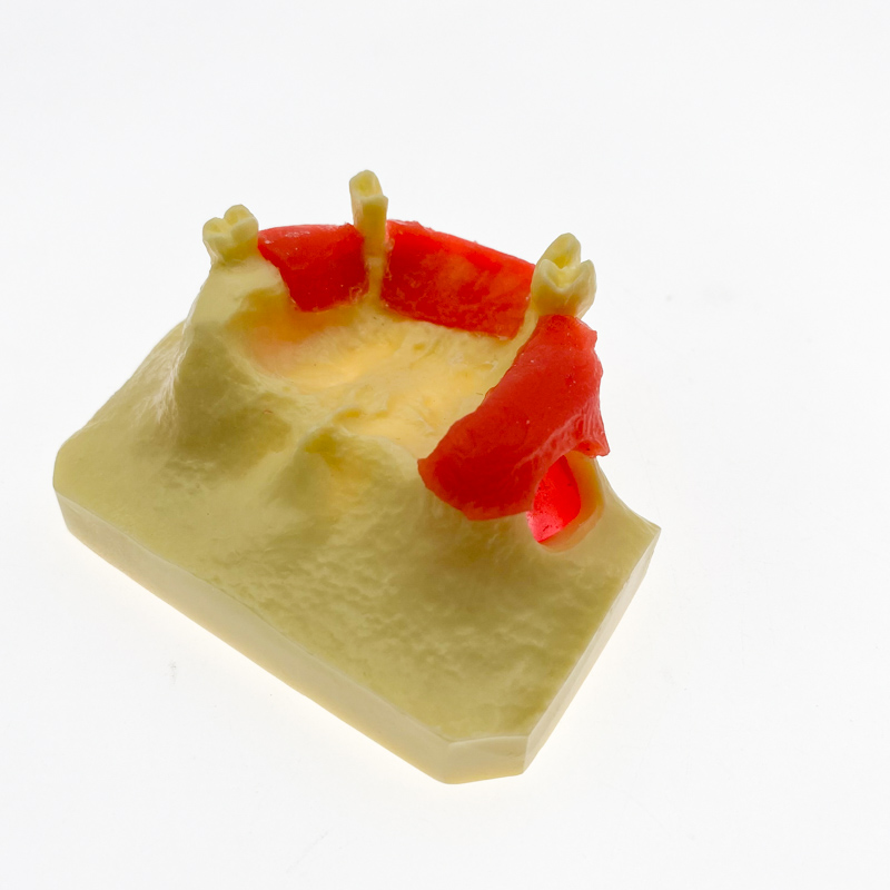 thumbnail image 2 of Maxillary Sinus Lift Practice Model – Dental Training Education – HANZE Typodont Teeth 2 of 6