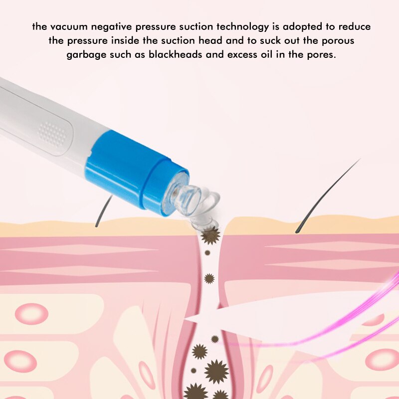 Blackhead Remover Vacuum Acne Remover Pore Cleaner Skin Facial Cleanser Kit Exfoliating Cleansing Facial Beauty tool