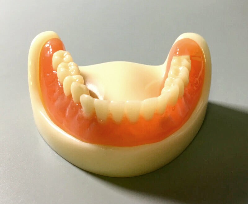 Modelo de dentadura completa Dental, accesorio magnético, estudio superior de la Mandibular: Lower DentureX1