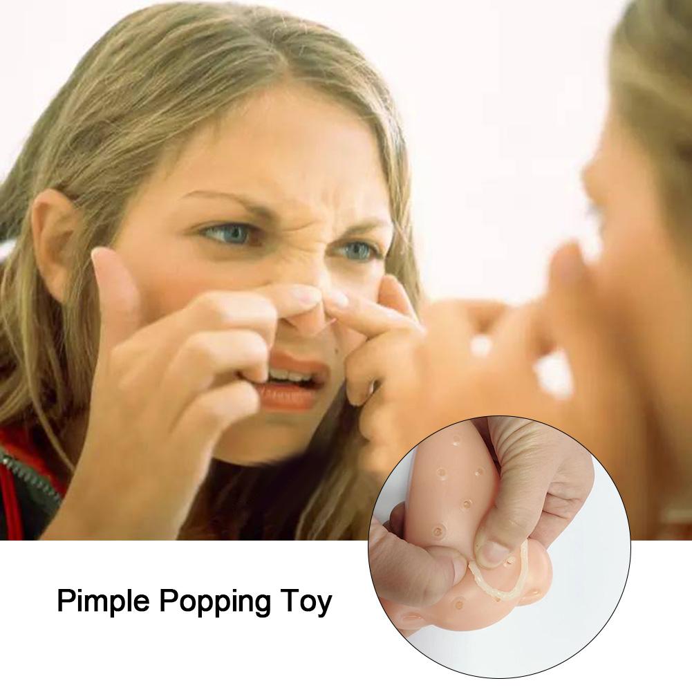 Squeezing Acne Hemorrhoids Pimple Popping Toy Acne Squeeze Toys Pressure Relief Prank Toy For Children Adult