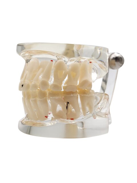 Dental Model For Children Deciduous Tooth Permanent Teeth Alternating Study Teathing Pediatric Dental Pathology Preventive Model: A