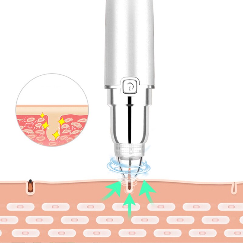 Face Blackhead Removal Vacuum Cleaner-Battery Operated Pore Cleaner Blackhead Removal Tool with 4 Replaceable Suction Cups for B
