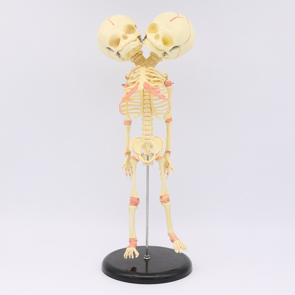 35CM crâne à deux têtes humain -né bébé Double tête anatomie crâne squelette anatomique éducation cérébrale modèle d'étude anatomique
