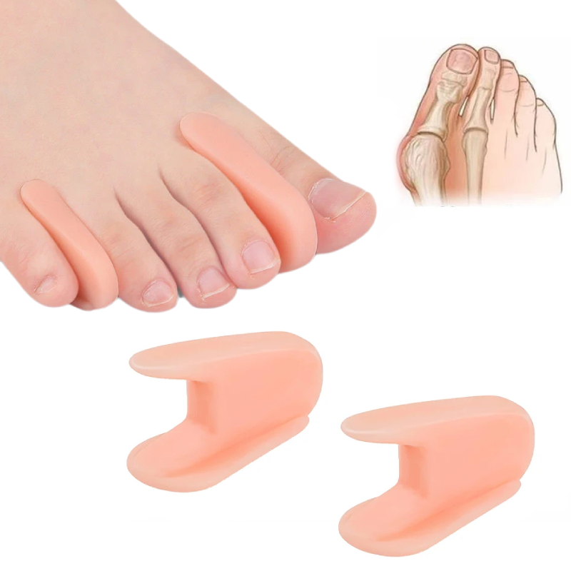 10 st = 5 par silikon benortoser för tummen, korrigerare för hallux valgus, tåseparator, fotvård, tumortoser, fotvårdsverktyg