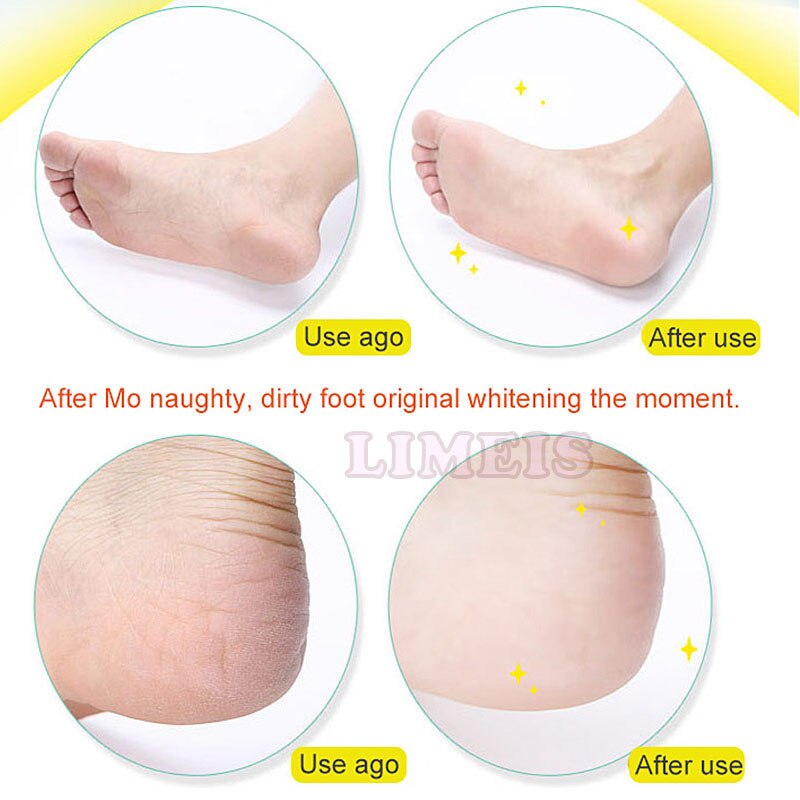 Elektrisk fodfjerner  w 3 stk ekstra slibehoveder fodpleje pedicure peeling død hud skrubbemaskine