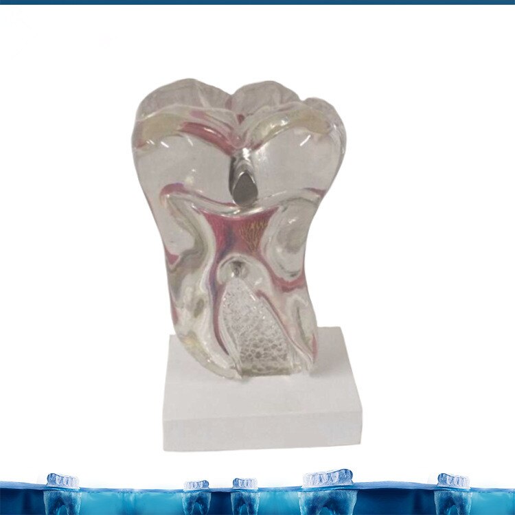6X Zes Keer De Tand Zenuw Anatomie Onderwijs Model Pathologische Tandheelkundige Tand Tanden Anatomie Model Medische Anatomie Odontologia