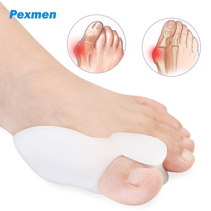 Pexmen 2 Teile/para Gel Zehe Separator Ballen Knochen Ektropium Erzähler Zehen Außen Gerät Fuß Pflege Werkzeuge Hallux Valgus Korrektor