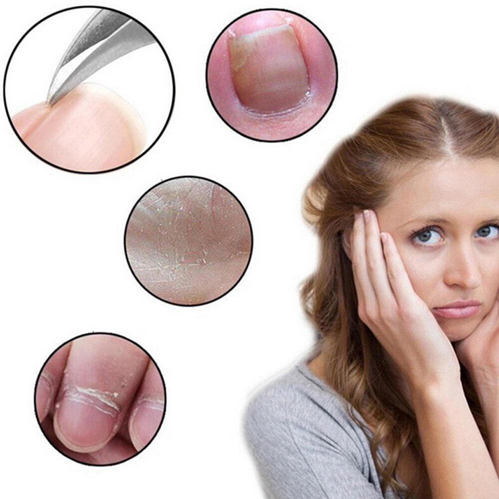 Manicureset voor dames, 3 -delige nagelgereedschapset voor dikke binnennagels, roestvrijstalen teennagelschaartje, aanbieding 3 j 05