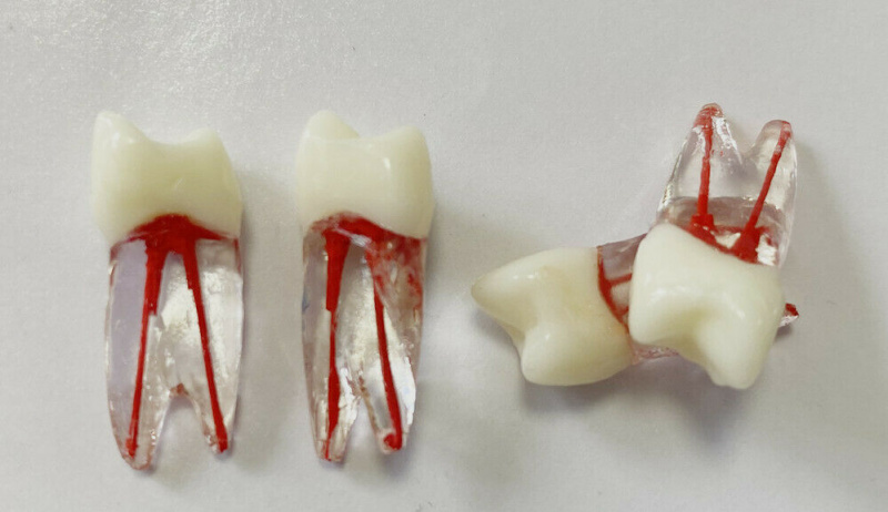 1~100pcs Dental Blocks Files Practice Red Pulp Root RCT Stimulation Bicuspid 14#