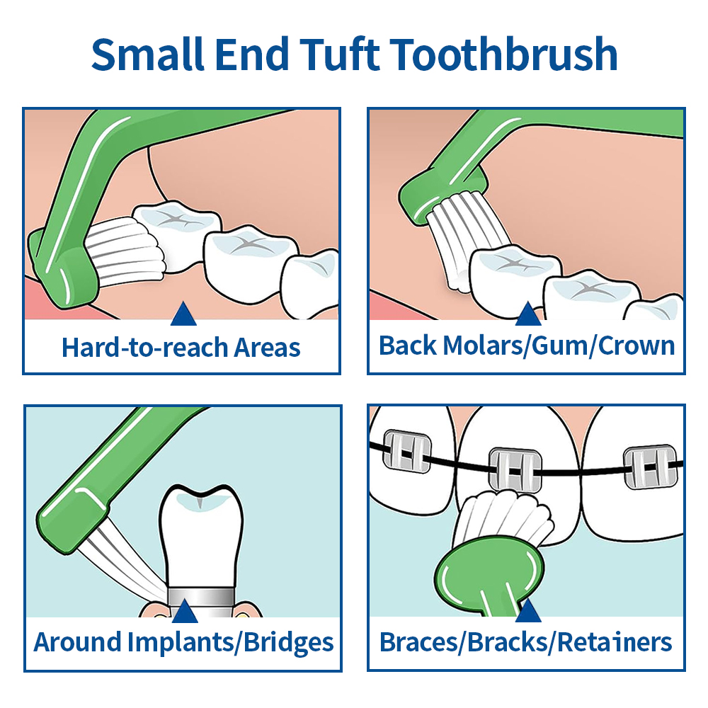 3Stck Kieferorthopädische Zahnbürste Kleinen Kopf Weiches Haar Reinigung Zahnbürste Interdentalbürste Oral Hygiene Zahnarzt Materialien
