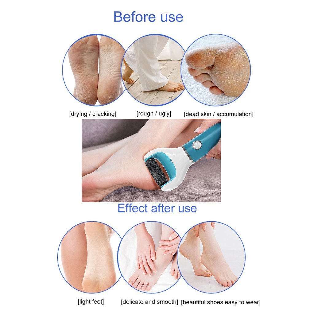 Electronic Feet Callus Remover Electric Foot File Rechargeable Hard Skin Pedicure Tools Feet Care Callus Remover Kit