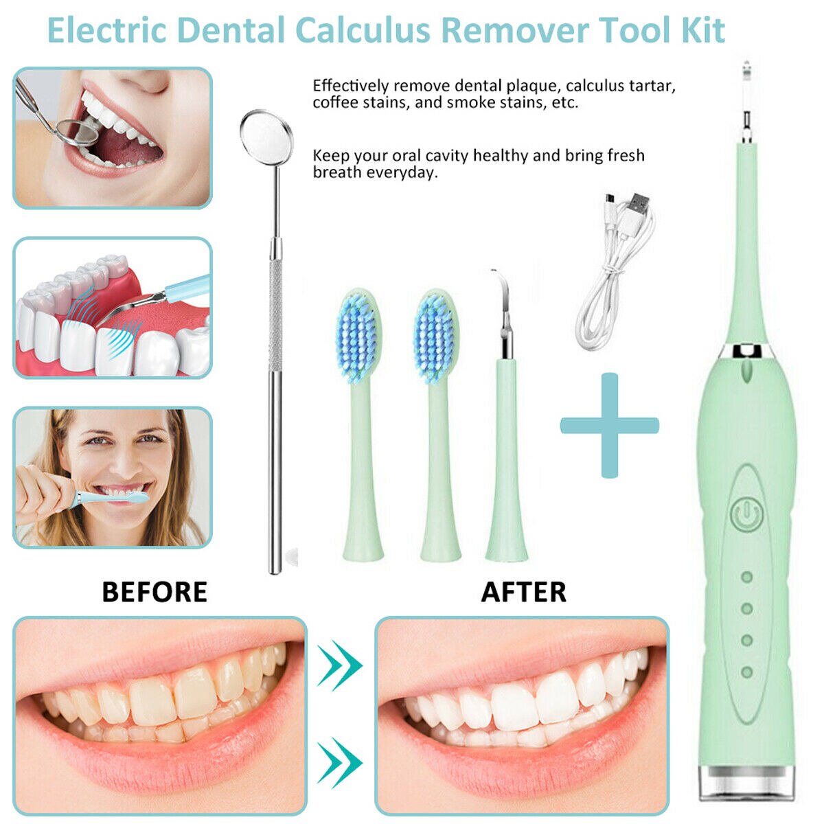Zahnstein Entferner Elektrische Zahnstein Entferner Ultraschall Zahn Schaber Reiniger Zahnstein Entferner für Dental Zähne Reinigung