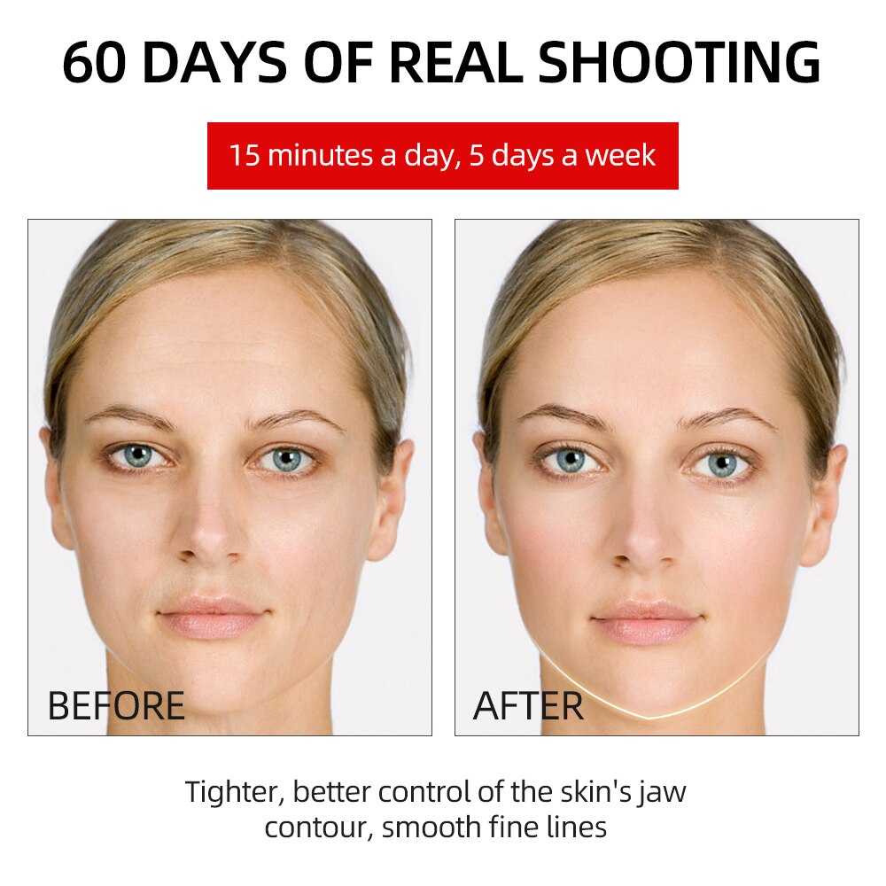 EMS V Face Shaper Lifting Facial Massager Double Chin Reducer LED Mesotherapy Radio Frequency Skin Tightening Wrinkle Removal